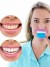 Wireless Blue LED Teeth Whitening Kit - Effective and Convenient | $5.39 | OKKO MODE