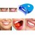 Wireless Blue LED Teeth Whitening Kit - Effective and Convenient | $5.39 | OKKO MODE