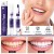Stylo dentifrice blanchissant gel sérum éclaircissant SAF - Voyage V34 | $3.24 | OKKO MODE