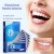 Autocollants de blanchiment des dents 9D - Bandes gel dentifrice soins bucco-dentaires | 3,24 $ | OKKO MODE