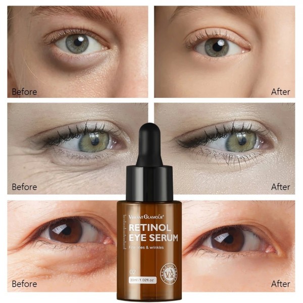 Crème blanchissante au rétinol, sérum pour les yeux - Essence anti-âge raffermissante lifting|11,99 €|OKKO MODE